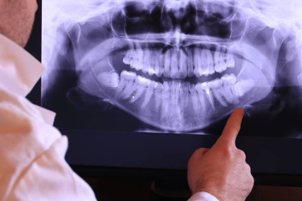 Best Teeth Whitening  in Jasper, AL